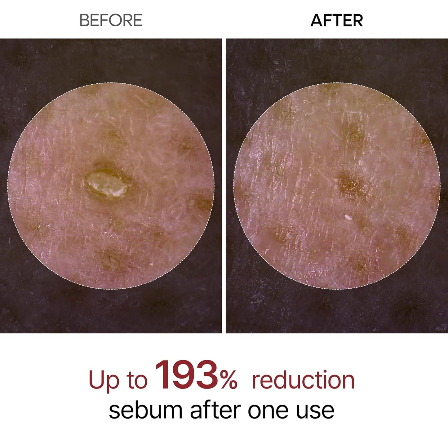 Dr.Melaxin Peel Shot - Glow Rise Peeling Ampoule, Soft Exfoliating Dead Skin Cells Remover